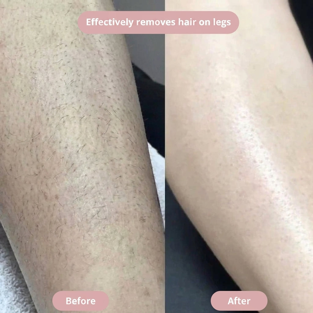 SilkGlide - Hair Removal For Intimate Areas Without Irritation